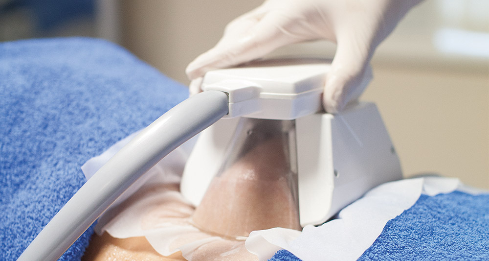 How Fat Freezing and HIFU Work Together? 2 Multiple Areas in One Session HIFU and Fat Freezing Windsor